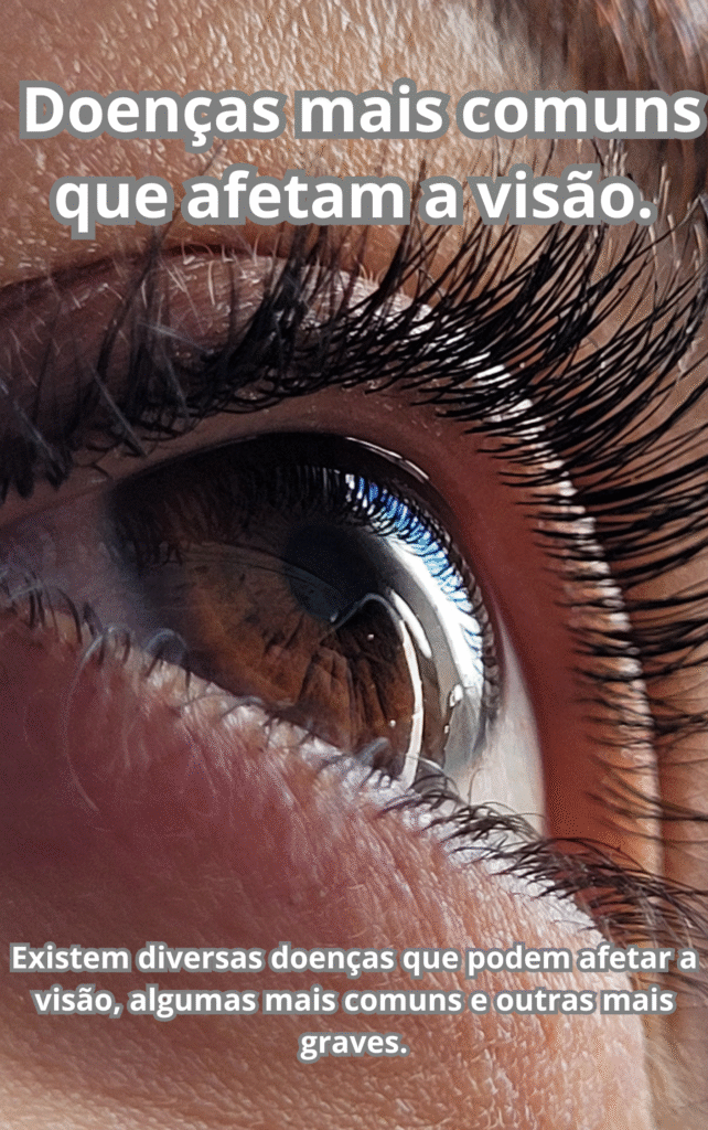 Doencas mais comuns que afetam a visao