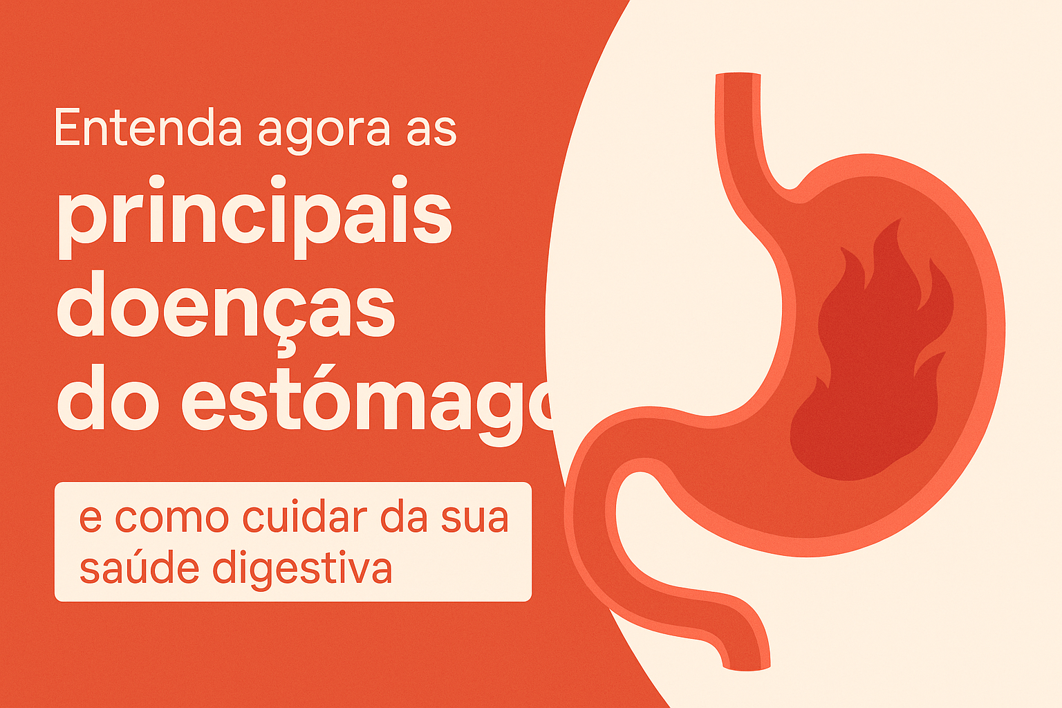 As principais doenças do estômago 5 As principais doenças do estômago
